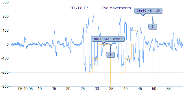 EDF Eye Movement Detection Annotations