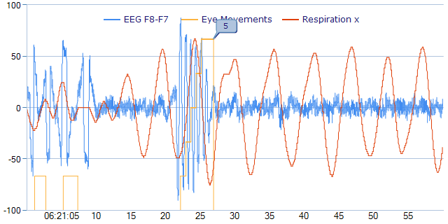EEG-06-21