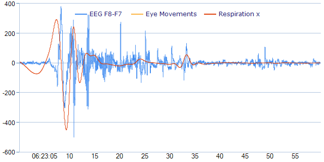 EEG-Toss-06-23