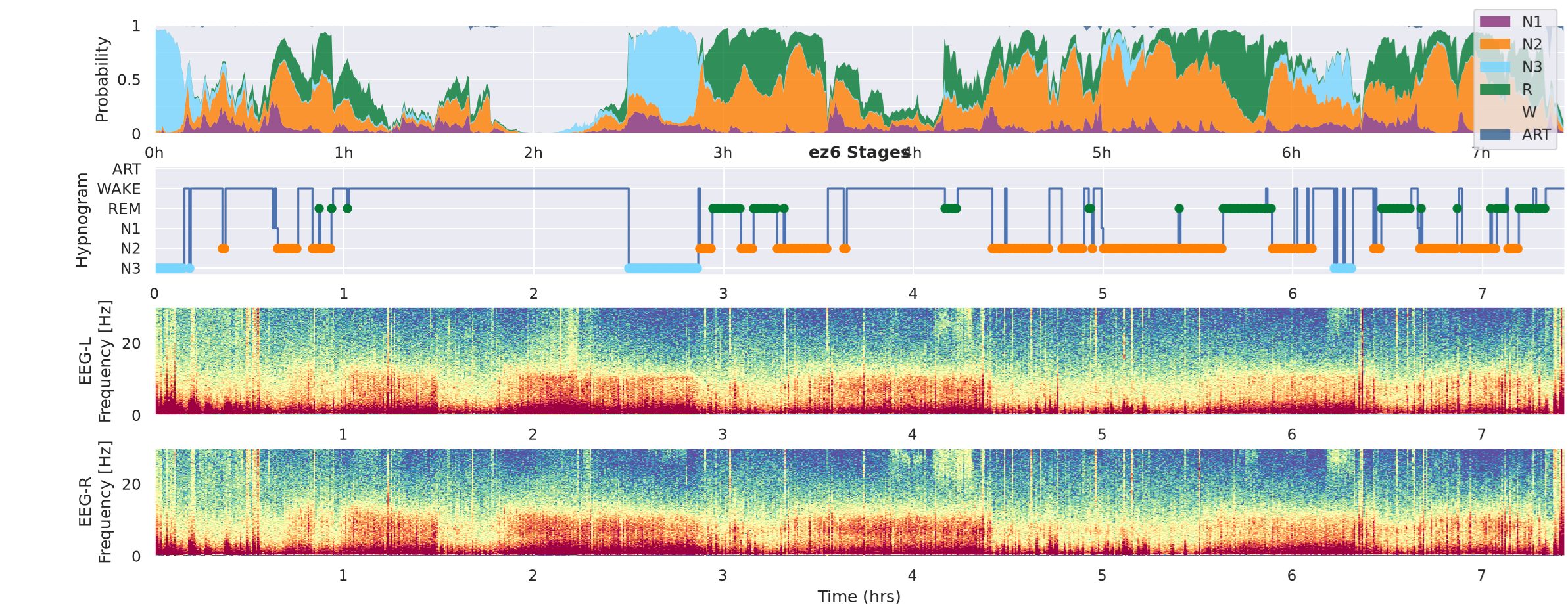 Lucid Scribe INSPEC vs CGX Patch EEG ezscore ez6
