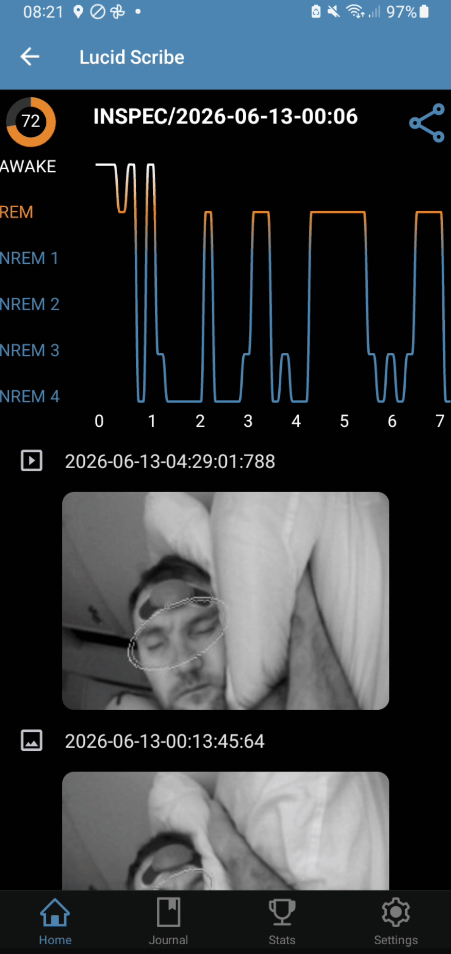 REM Sleep - Lucid Scribe INSPEC with CGX Patch EEG