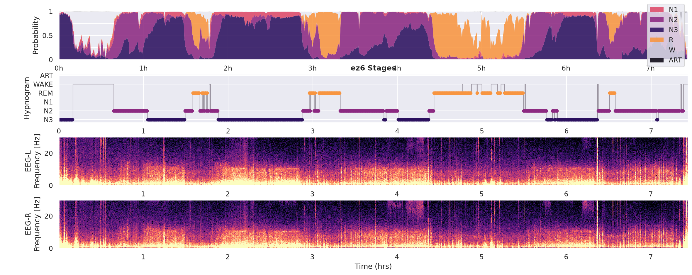 Lucid Scribe INSPEC vs CGX Patch EEG ezscore ez6